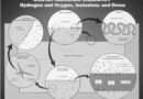 Aluminium melting dross factors